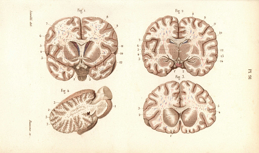 Sections through the brain