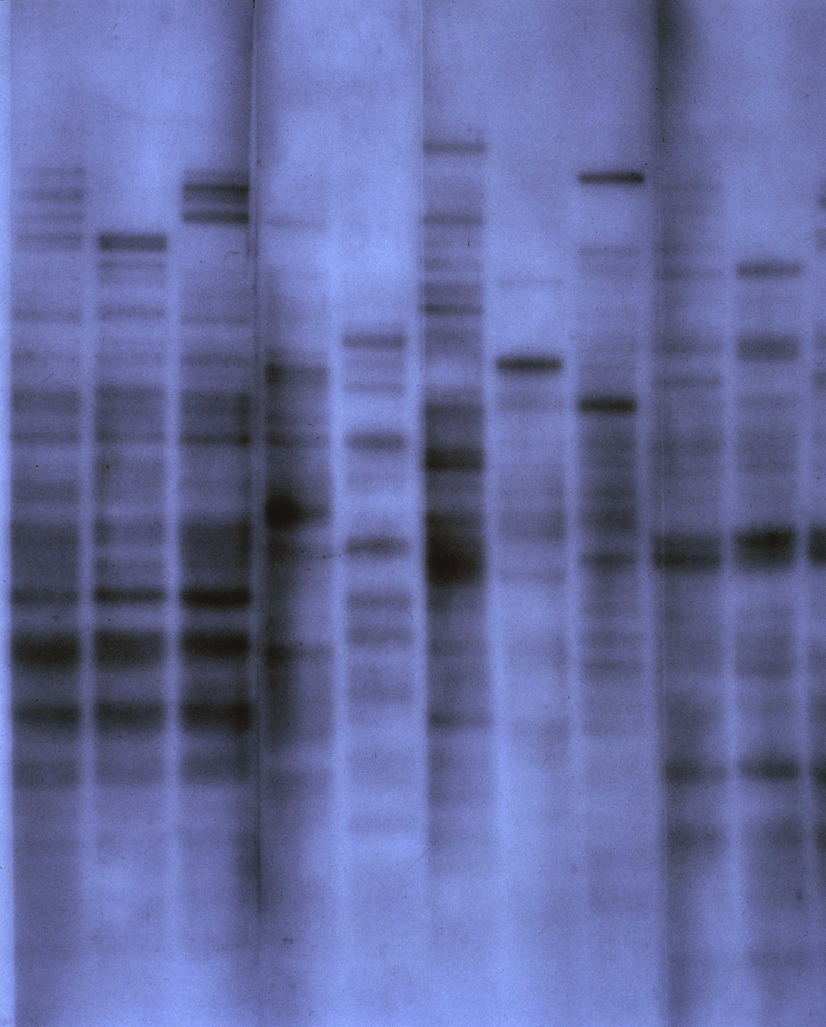 The first genetic fingerprint, 1984 © Science Museum / SSPL