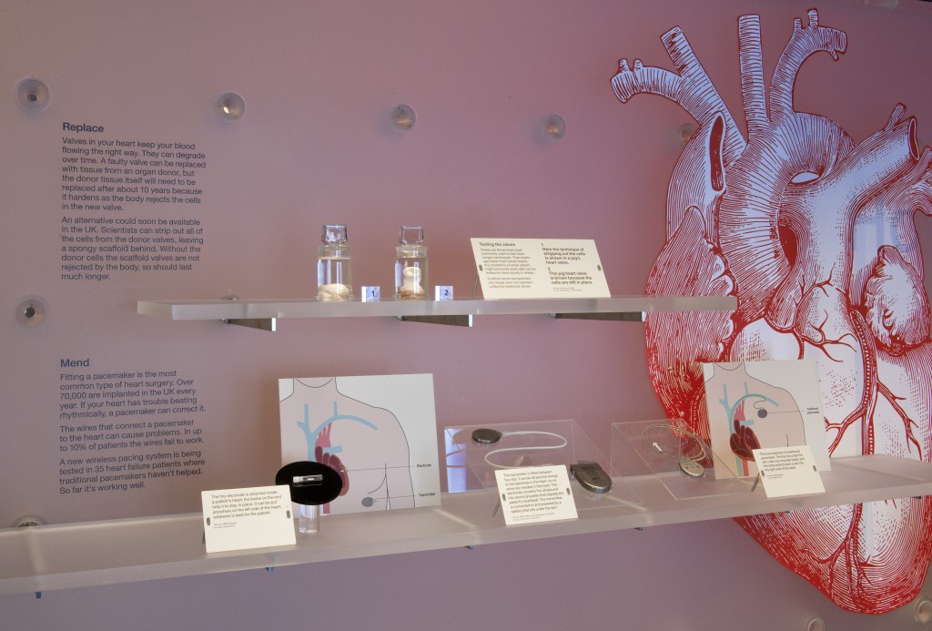 How to mend a broken heart display, showcasing how innovations in surgery are allowing us to live longer than ever before. Credit: Science Museum