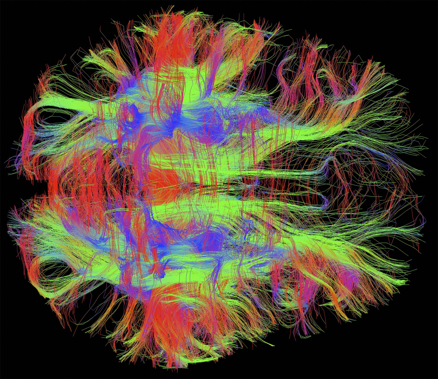 Nerve fibers in a healthy adult human brain