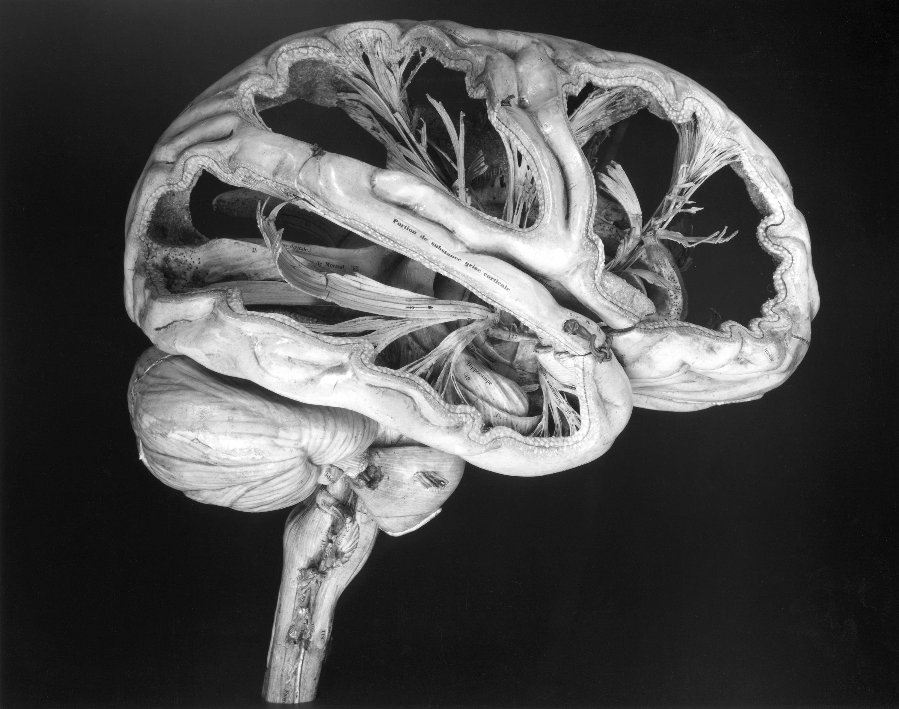 Model of a human brain, sectioned, French, first half 19th century. The model shows a sectioned human brain made from papier mâché. The parts can be removed to show the internal structure of the brain. Each is labelled with a number and some of the parts have the name of the section printed in French. This model was used as an aid to teach anatomy. Detail view on black background.