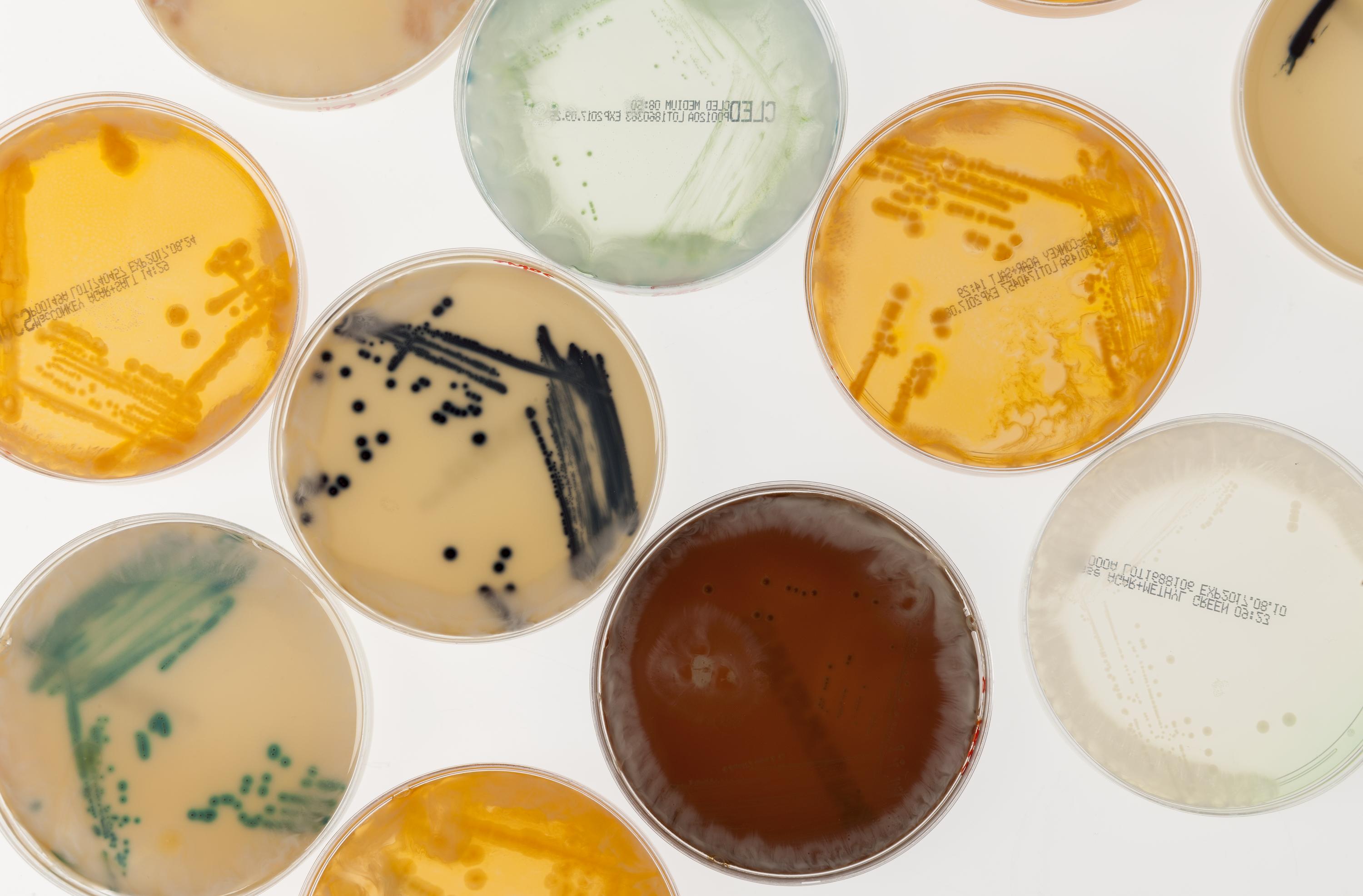 The incredible biodiversity of microbes on Earth is a testament to the complex relationships that they develop. How would a foreign bacterium interact with these complex systems?