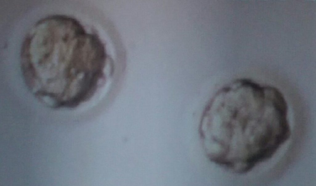 Two five day old embryos grown in the lab, one of which is Gareth’s son. Courtesy of Gareth Down