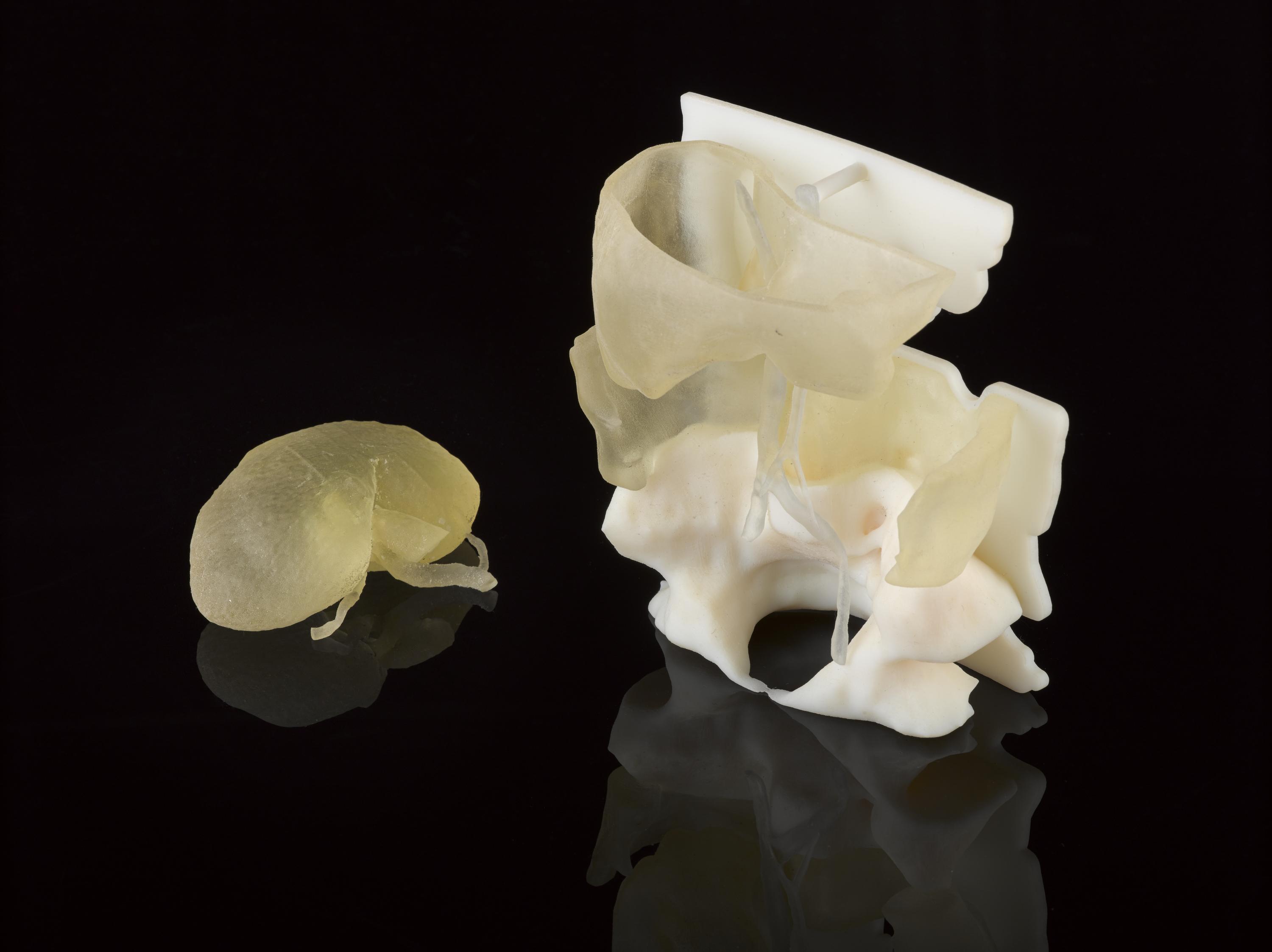 3D printed 1:1 models of a right adult kidney and child’s abdomen, 2015