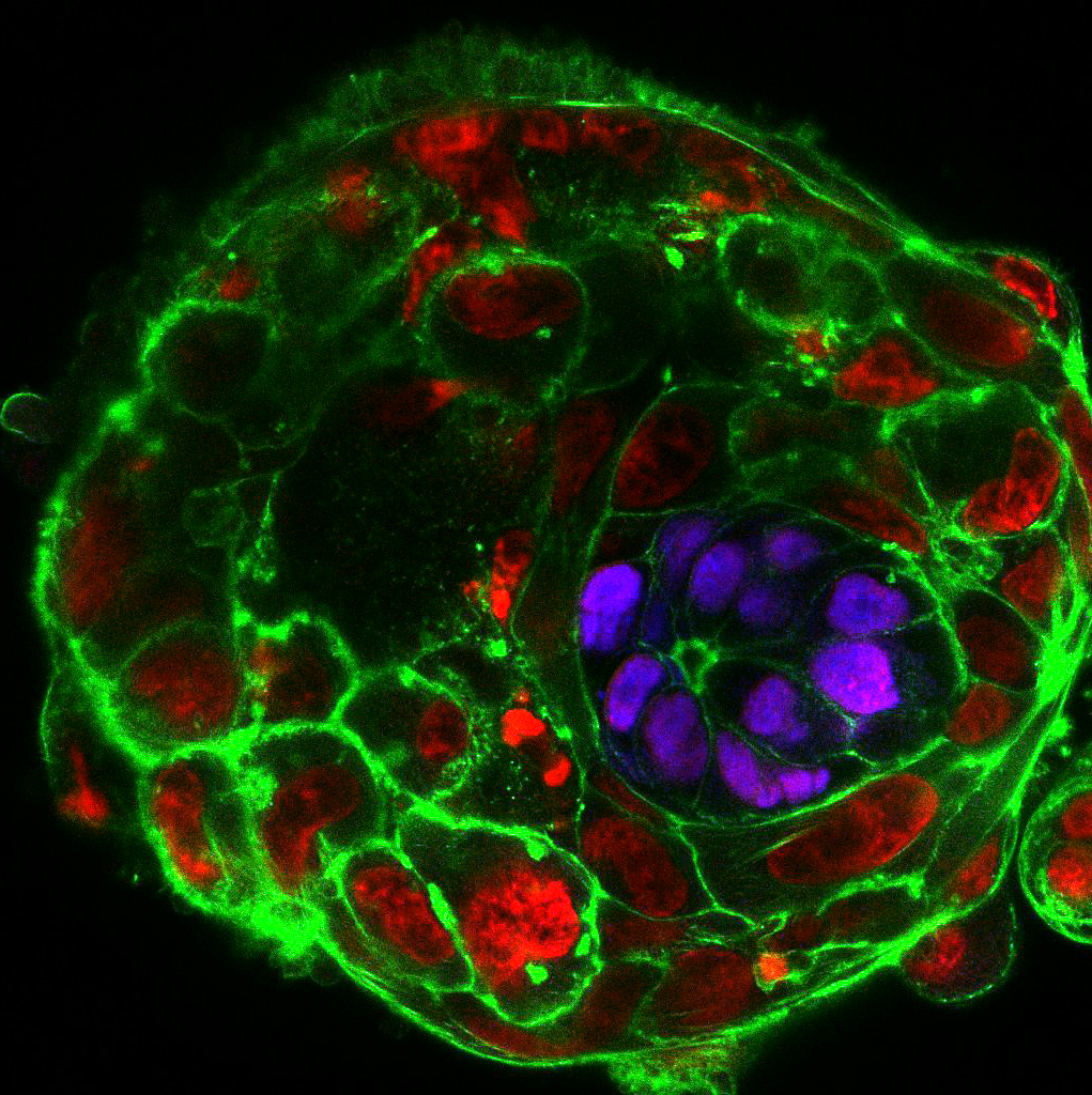A day 10 human embryo cultured in vitro: cells labeled in magenta will make the future fetus and cells labeled in red will make the placenta. The green signal delineates the shapes of the cells. At this stage the embryo is smaller than a grain of sand.