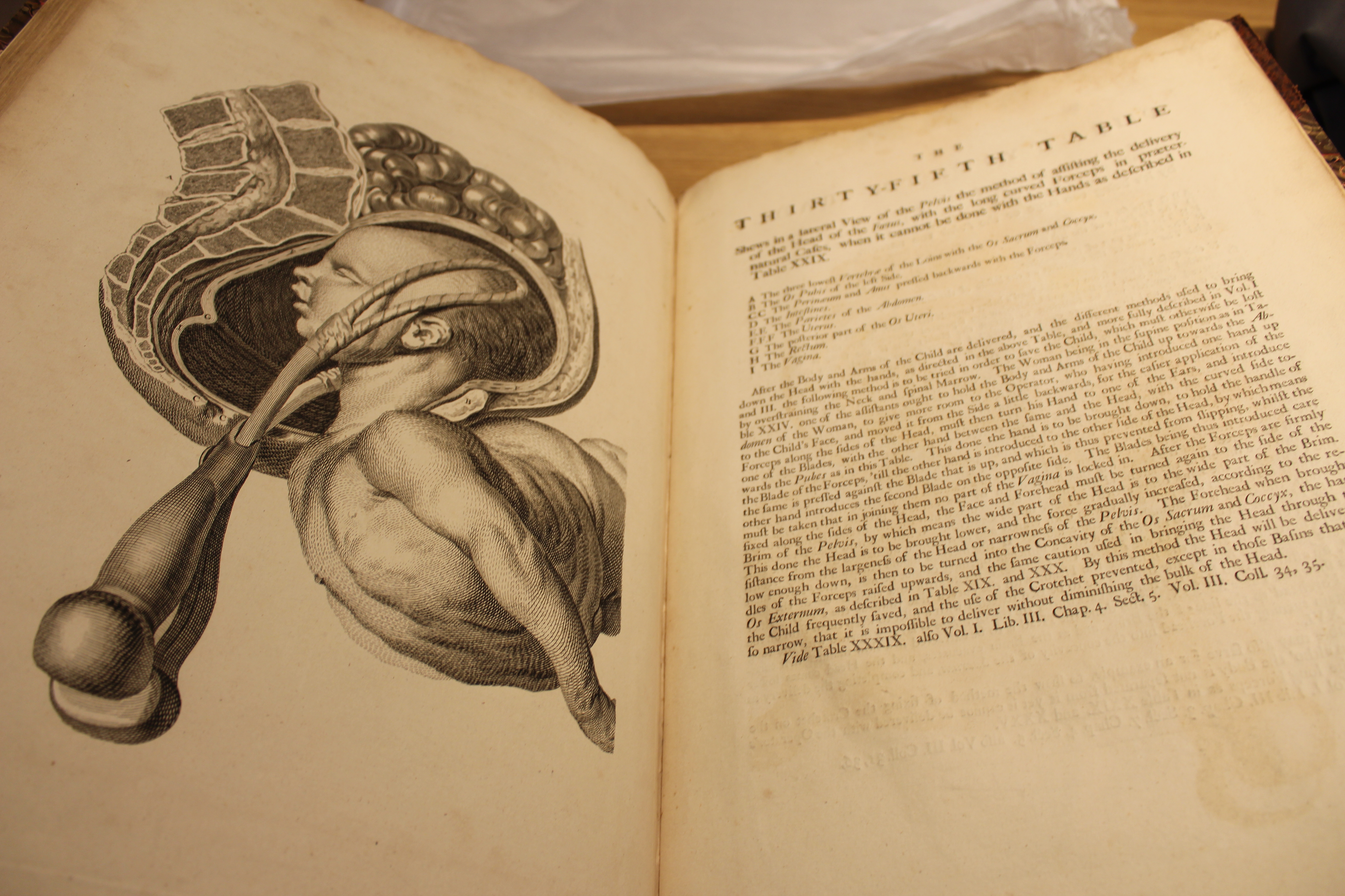 William Smellie, 'A sett of anatomical tables, with explanations, and an abridgement, of the practice of midwifery: with a view to illustrate a treatise on that subject, and collection of cases'. London, 1754