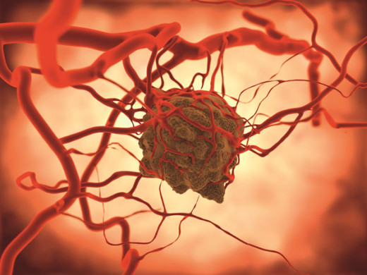 Endomag’s breast cancer staging diagnostic system accurately locates individual sentinel nodes so surgeons can identify where a cancerous tumour has spread.