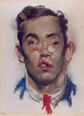 Pastel sketch by Henry Tonks. © The Royal College of Surgeons of England