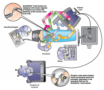 Operating theatre set up Credit: ©2017 Intuitive Surgical, Inc.