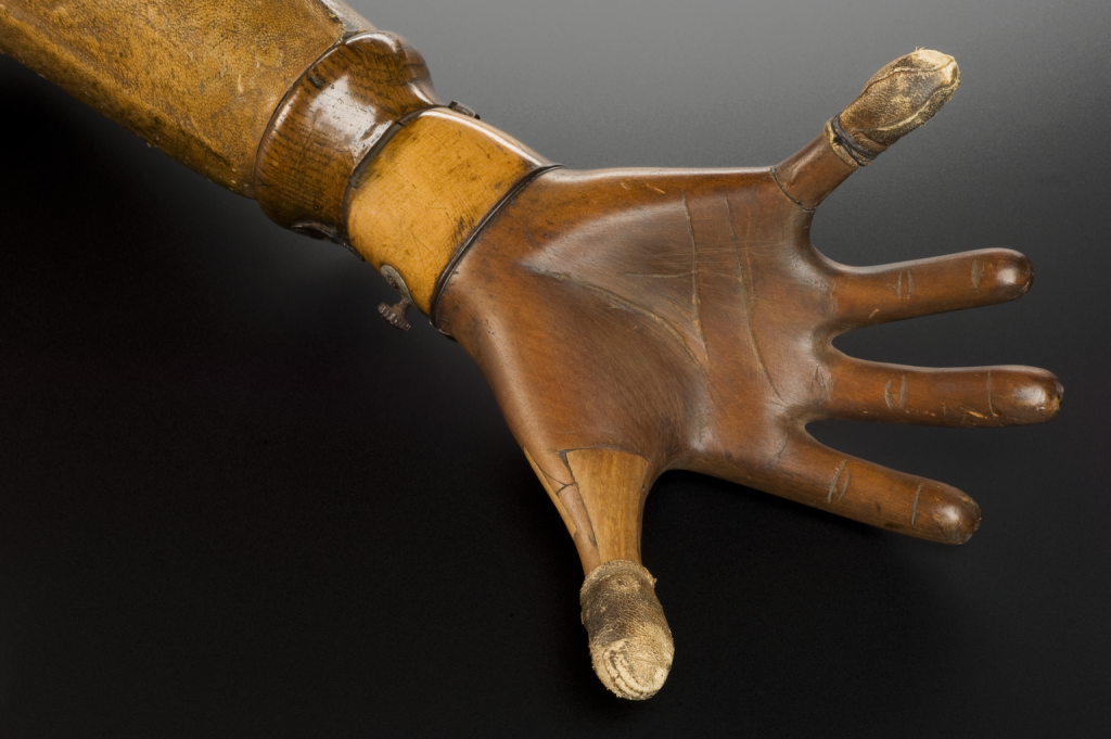 Right below elbow prosthesis, made for a pianist.