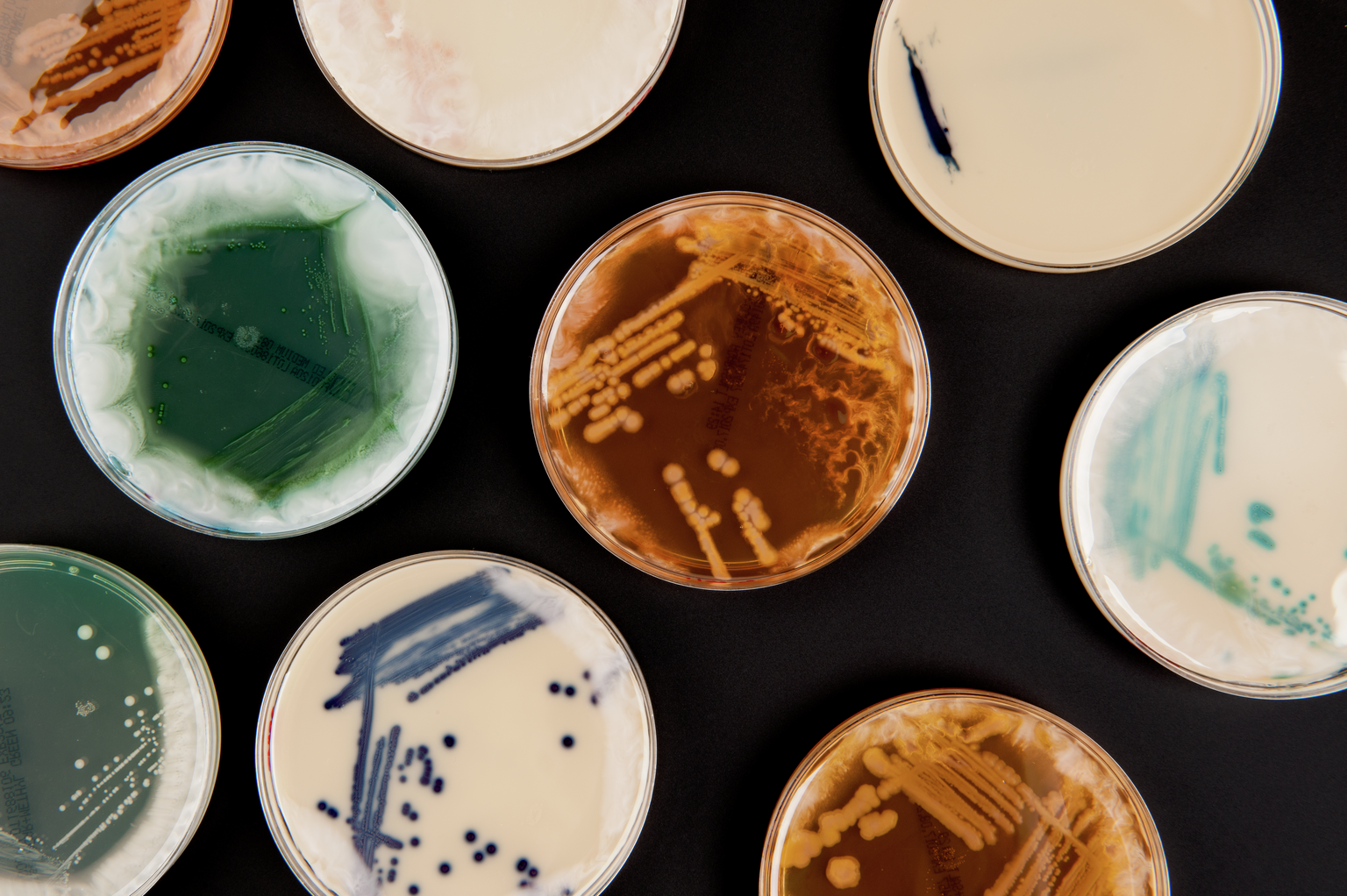 Enterobacter cloacae, Enterococcus faecalis, Staphylococcus epidermidis & Escherichia coli from the Superbugs exhibition.
