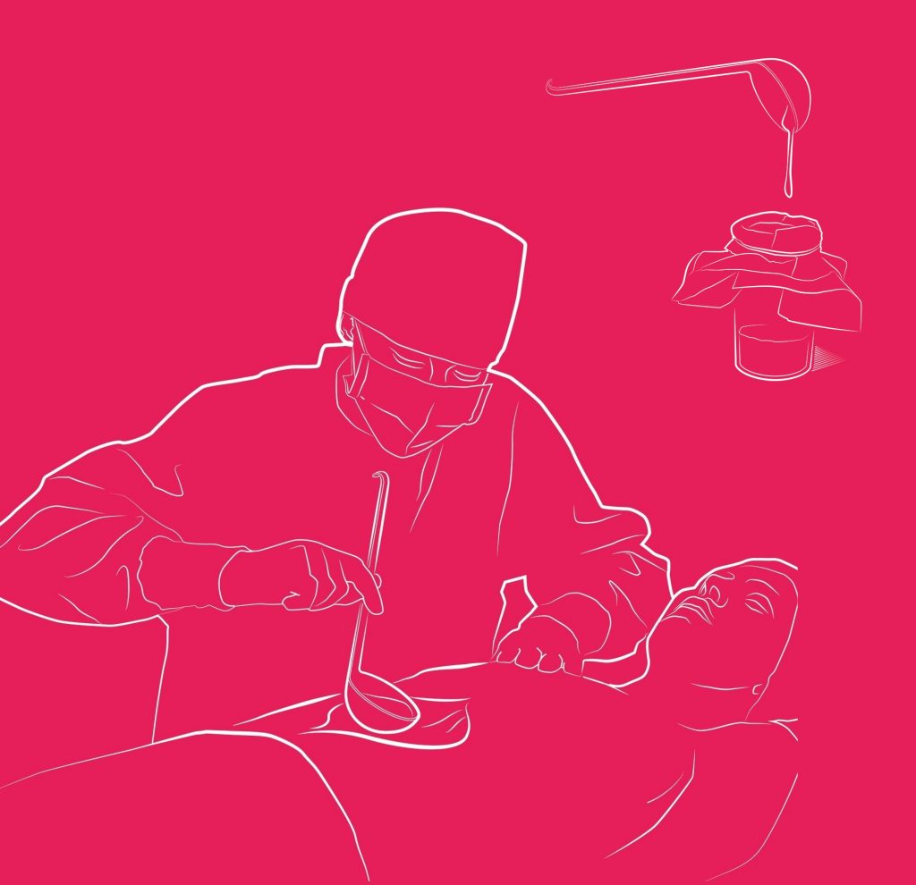 The soup-ladle technique. Credit: David Wojcik