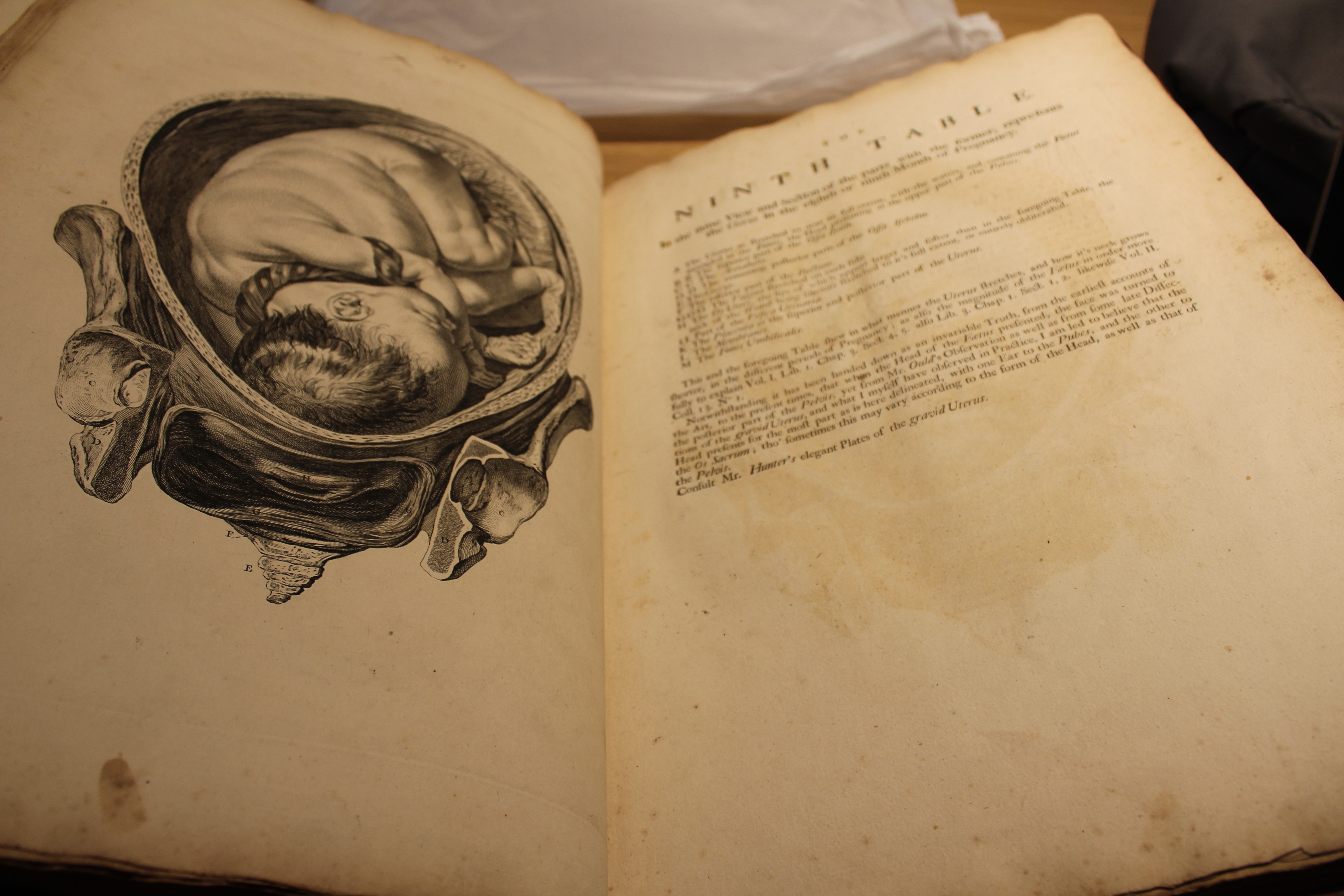 William Smellie, 'A sett of anatomical tables, with explanations, and an abridgement, of the practice of midwifery: with a view to illustrate a treatise on that subject, and collection of cases'. London, 1754